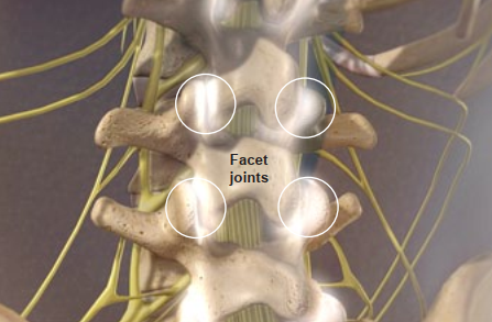 Normal facet joint