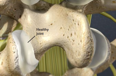 Example of a healthy joint