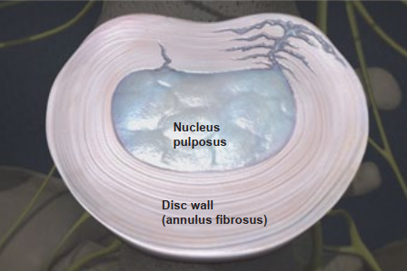 Nucleus pulposus and disc wall